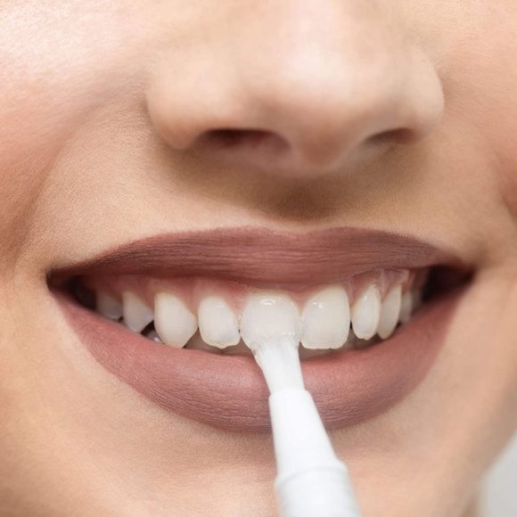 NEW Professional Teeth Whitening On The Go Gel Pen - Picture 5 of 8